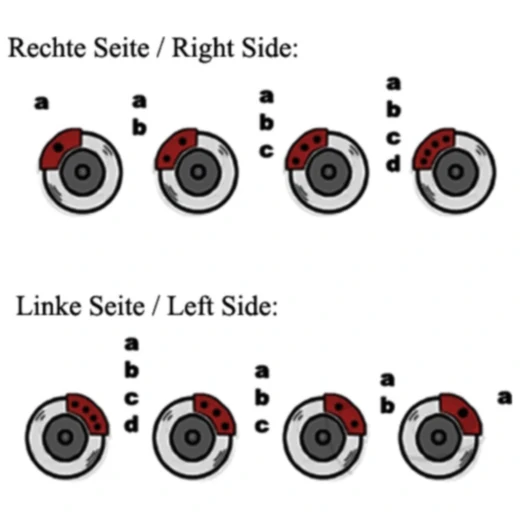 Bremssattelkolben Reparatursatz Tourmax passend für: Kawasaki K